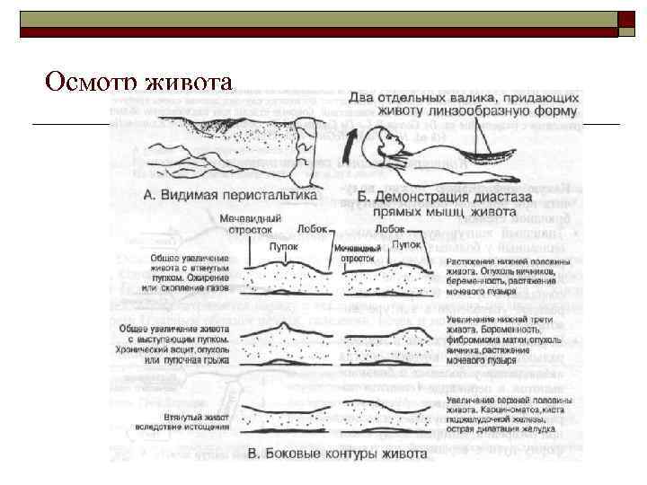Осмотр живота 