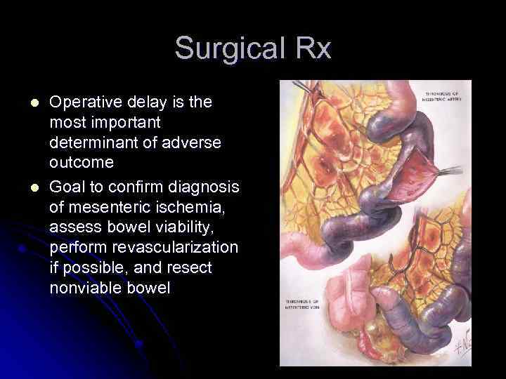 Surgical Rx l l Operative delay is the most important determinant of adverse outcome