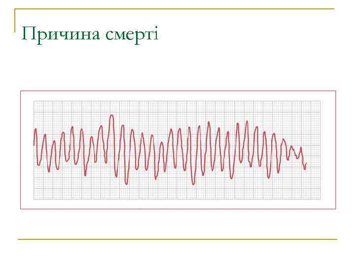 Причина смерті 