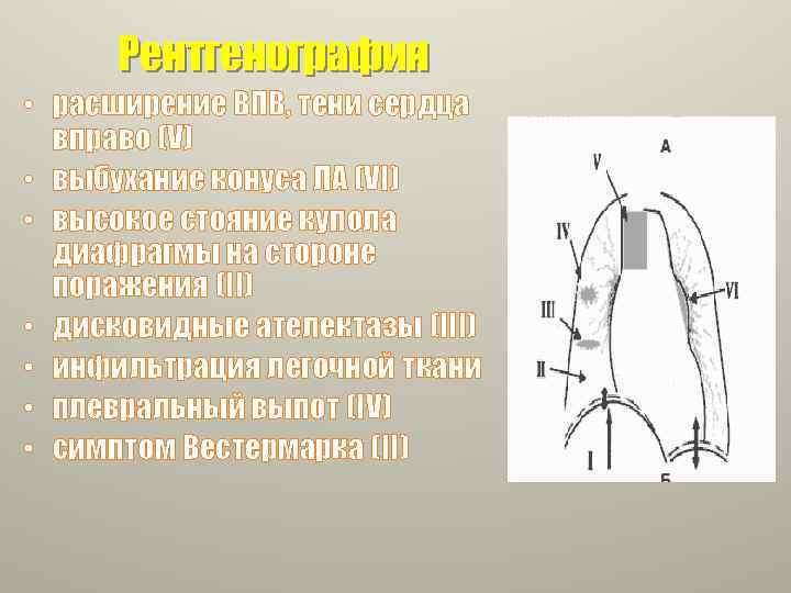 Рентгенография • расширение ВПВ, тени сердца вправо (V) • выбухание конуса ЛА (VI) •