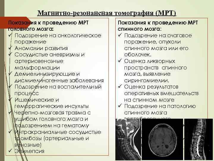 Магнитно-резонансная томография (МРТ) Показания к проведению МРТ головного мозга: ü Подозрение на онкологическое поражение