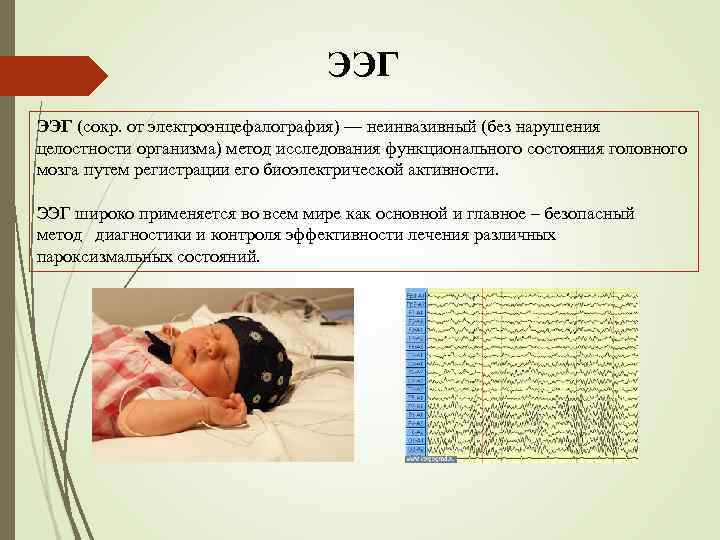 ЭЭГ (сокр. от электроэнцефалография) — неинвазивный (без нарушения целостности организма) метод исследования функционального состояния