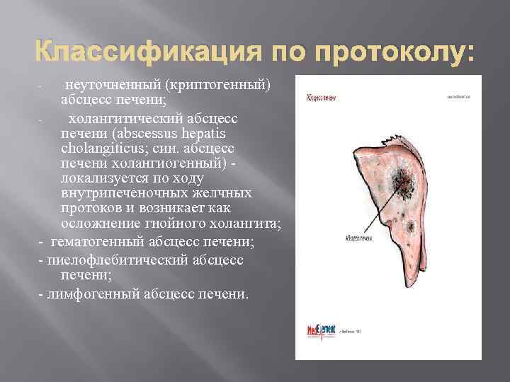Классификация по протоколу: неуточненный (криптогенный) абсцесс печени; холангитический абсцесс печени (abscessus hepatis cholangiticus; син.