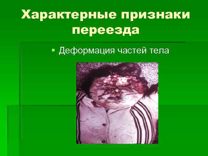 Характерные признаки переезда § Деформация частей тела 