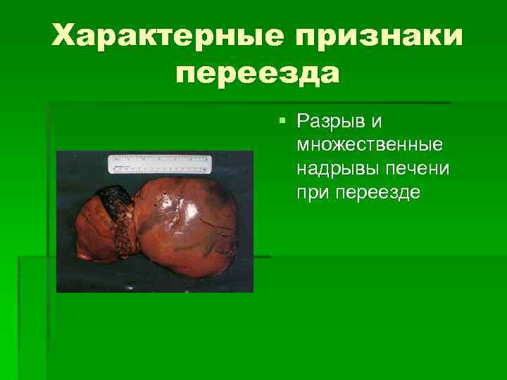 Характерные признаки переезда § Разрыв и множественные надрывы печени при переезде 