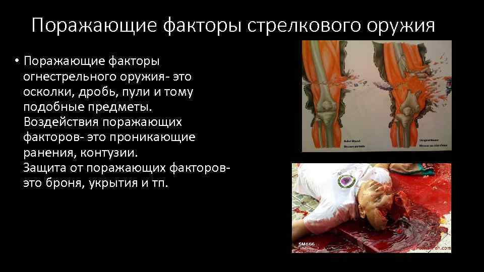 Поражающие факторы стрелкового оружия • Поражающие факторы огнестрельного оружия- это осколки, дробь, пули и