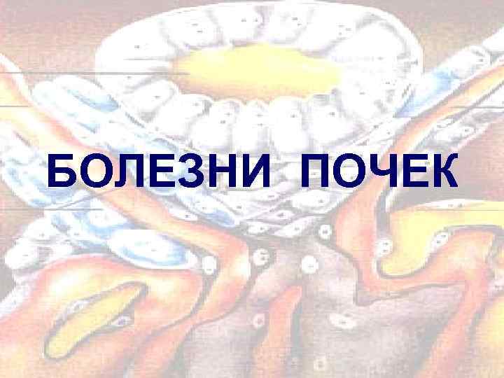 БОЛЕЗНИ ПОЧЕК 