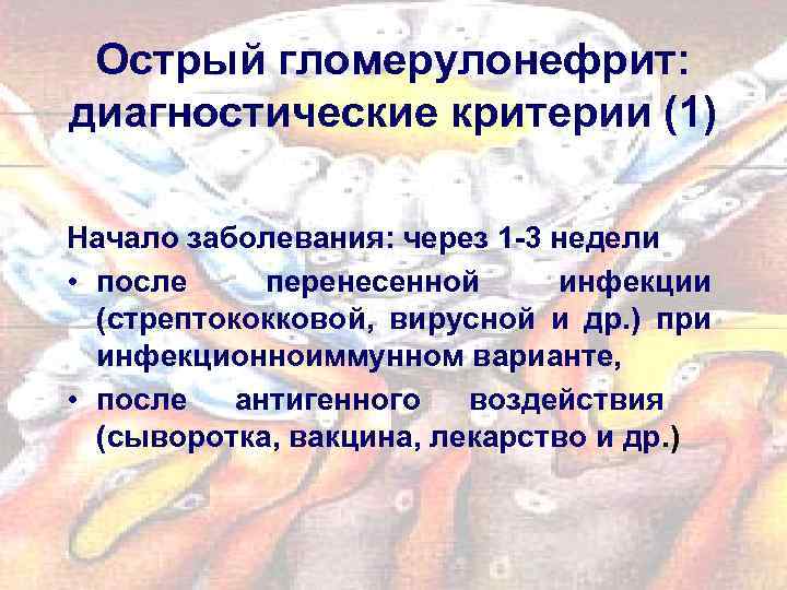 Острый гломерулонефрит: диагностические критерии (1) Начало заболевания: через 1 -3 недели • после перенесенной