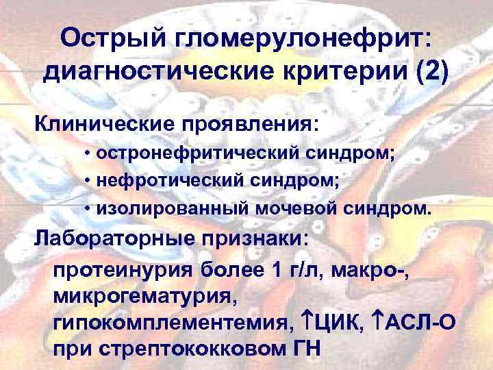 Острый гломерулонефрит: диагностические критерии (2) Клинические проявления: • остронефритический синдром; • нефротический синдром; •