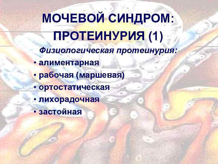 МОЧЕВОЙ СИНДРОМ: ПРОТЕИНУРИЯ (1) Физиологическая протеинурия: • алиментарная • рабочая (маршевая) • ортостатическая •