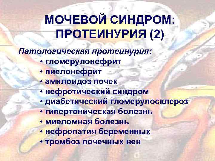 МОЧЕВОЙ СИНДРОМ: ПРОТЕИНУРИЯ (2) Патологическая протеинурия: • гломерулонефрит • пиелонефрит • амилоидоз почек •