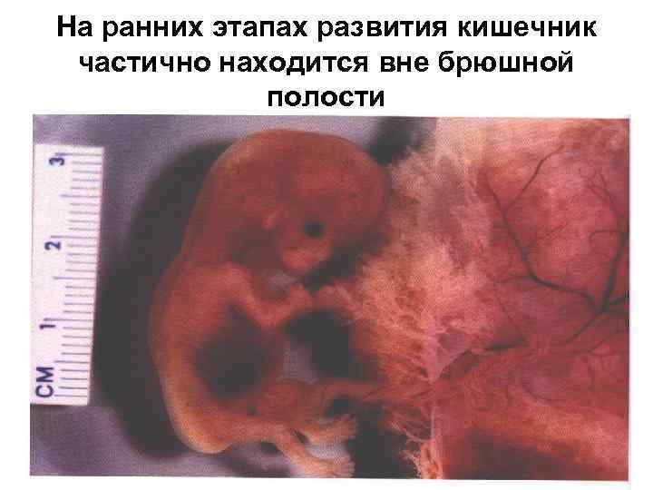 На ранних этапах развития кишечник частично находится вне брюшной полости 