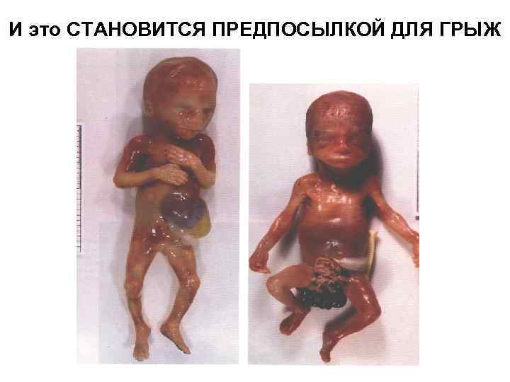 И это СТАНОВИТСЯ ПРЕДПОСЫЛКОЙ ДЛЯ ГРЫЖ 