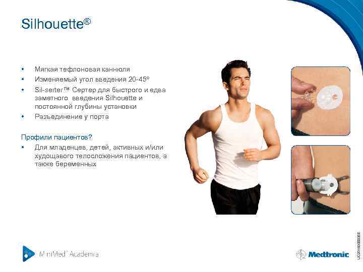 Silhouette® • • Мягкая тефлоновая каннюля Изменяемый угол введения 20 -45º Sil-serter™ Сертер для