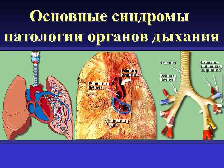 Основные синдромы патологии органов дыхания 