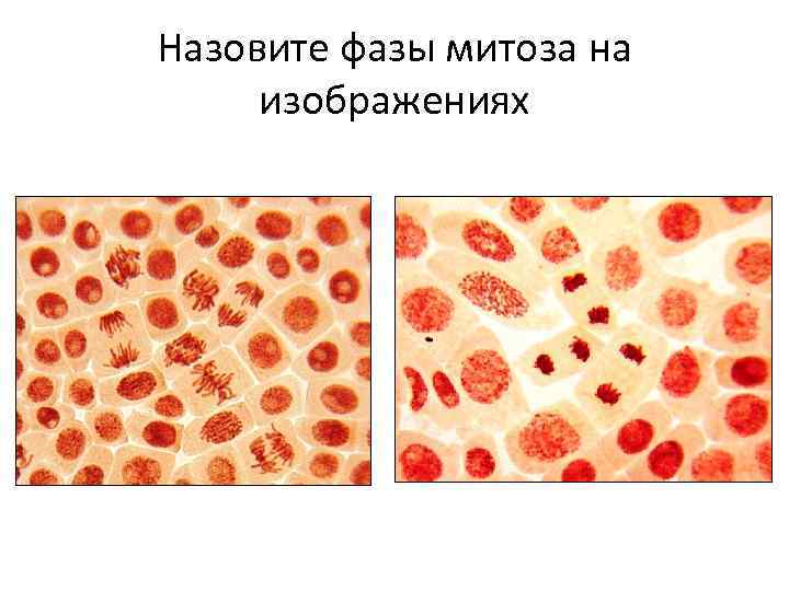Назовите фазы митоза на изображениях 