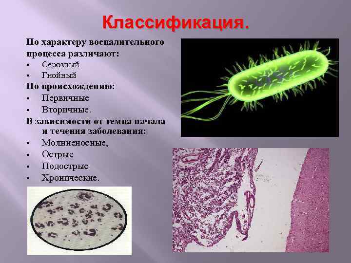 Классификация. По характеру воспалительного процесса различают: § § Серозный Гнойный По происхождению: § Первичные