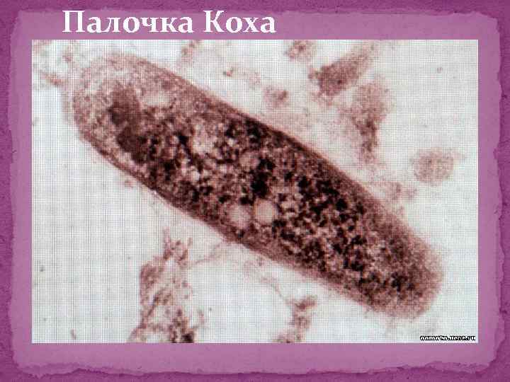 Палочка Коха 