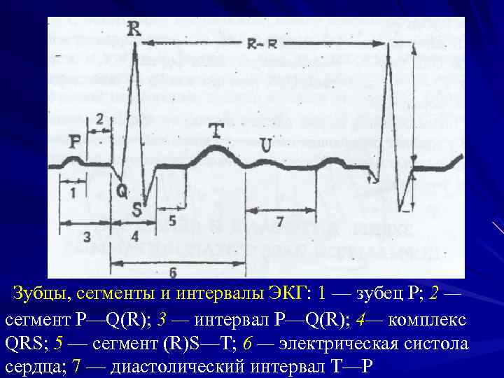 Происхождение зубца r на экг связано с