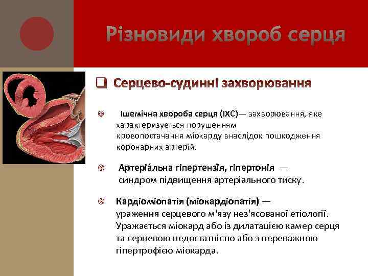 Різновиди хвороб серця q Серцево-судинні захворювання Ішемічна хвороба серця (ІХС)— захворювання, яке характеризується порушенням