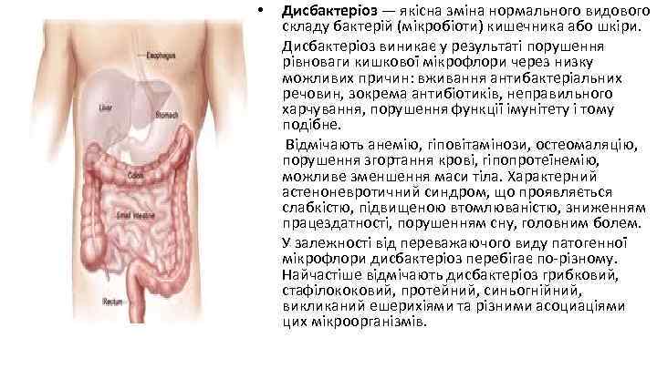 • • Дисбактеріоз — якісна зміна нормального видового складу бактерій (мікробіоти) кишечника або