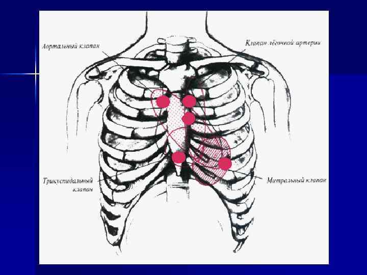 Клапаны сердца схема аускультации