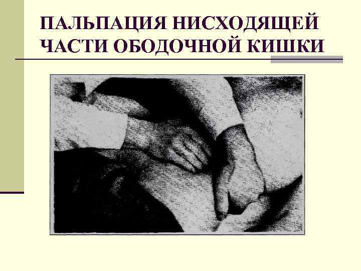 ПАЛЬПАЦИЯ НИСХОДЯЩЕЙ ЧАСТИ ОБОДОЧНОЙ КИШКИ 