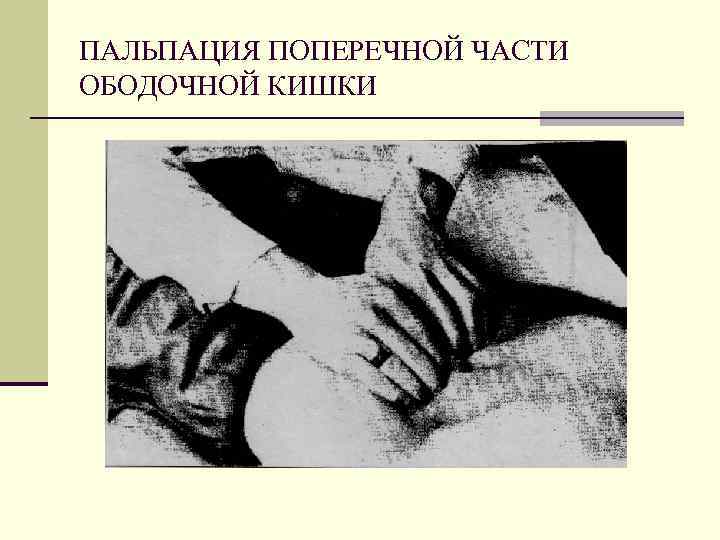 ПАЛЬПАЦИЯ ПОПЕРЕЧНОЙ ЧАСТИ ОБОДОЧНОЙ КИШКИ 