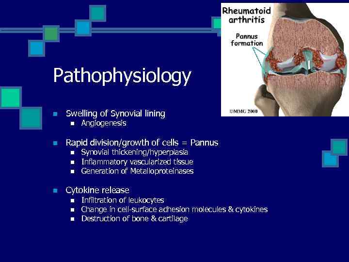 Pathophysiology n Swelling of Synovial lining n n Rapid division/growth of cells = Pannus