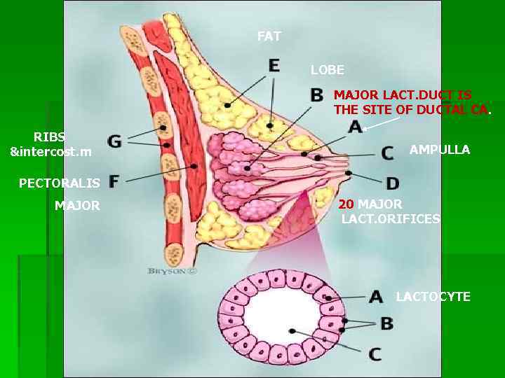 FAT LOBE MAJOR LACT. DUCT IS THE SITE OF DUCTAL CA. RIBS &intercost. m