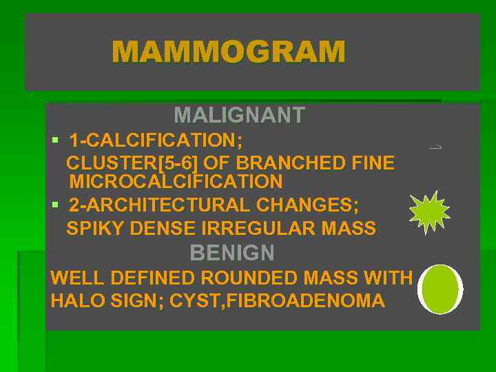 MAMMOGRAM MALIGNANT § 1 -CALCIFICATION; CLUSTER[5 -6] OF BRANCHED FINE MICROCALCIFICATION § 2 -ARCHITECTURAL