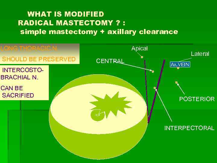 WHAT IS MODIFIED RADICAL MASTECTOMY ? : simple mastectomy + axillary clearance LONG THORACIC
