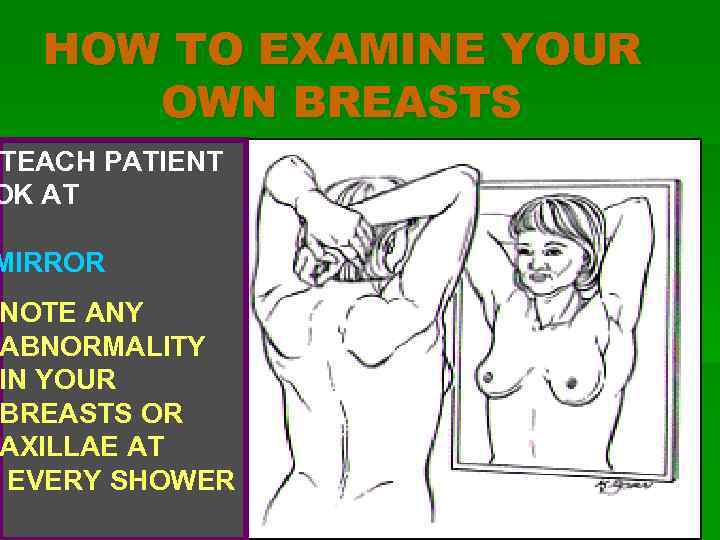 HOW TO EXAMINE YOUR OWN BREASTS TEACH PATIENT OK AT MIRROR NOTE ANY ABNORMALITY