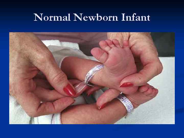 Normal Newborn Infant 