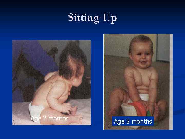 Sitting Up Age 2 months Age 8 months 
