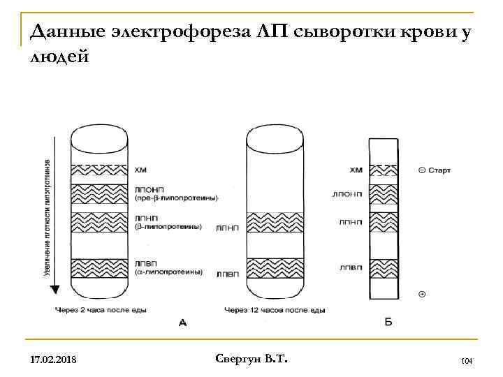 Данные электрофореза ЛП сыворотки крови у людей 17. 02. 2018 Свергун В. Т. 104