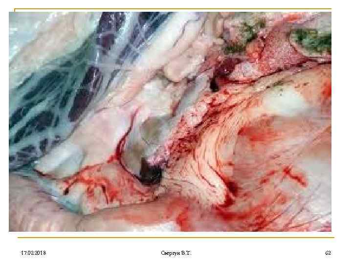 17. 02. 2018 Свергун В. Т. 62 