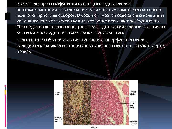 У человека при гипофункции околощитовиднык желез возникает метания - заболевание, характерным симптомом которого являются
