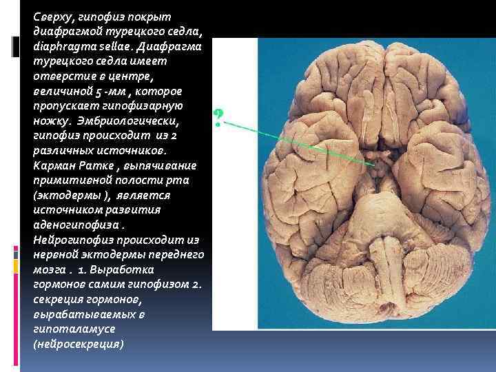 Сверху, гипофиз покрыт диафрагмой турецкого седла, diaphragma sellae. Диафрагма турецкого седла имеет отверстие в