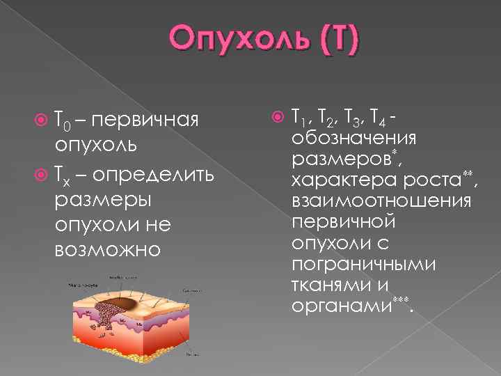 Опухоль (Т) Т 0 – первичная опухоль Тх – определить размеры опухоли не возможно