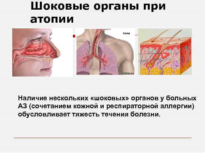 Шоковые органы при атопии Наличие нескольких «шоковых» органов у больных АЗ (сочетанием кожной и
