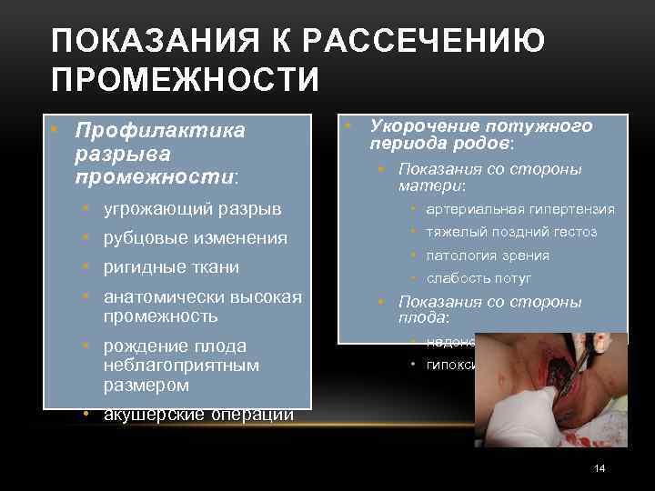 ПОКАЗАНИЯ К РАССЕЧЕНИЮ ПРОМЕЖНОСТИ • Профилактика разрыва промежности: • Укорочение потужного периода родов: •