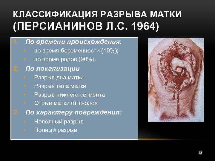 КЛАССИФИКАЦИЯ РАЗРЫВА МАТКИ (ПЕРСИАНИНОВ Л. С. 1964) 1. По времени происхождения: • • 2.