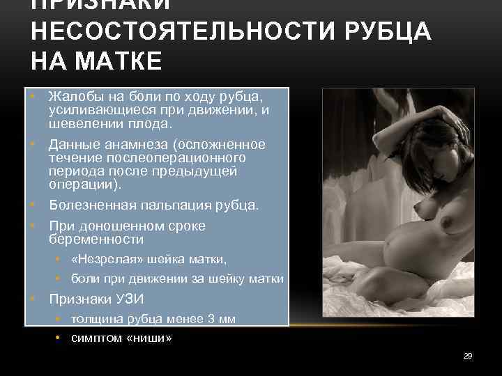 ПРИЗНАКИ НЕСОСТОЯТЕЛЬНОСТИ РУБЦА НА МАТКЕ • Жалобы на боли по ходу рубца, усиливающиеся при