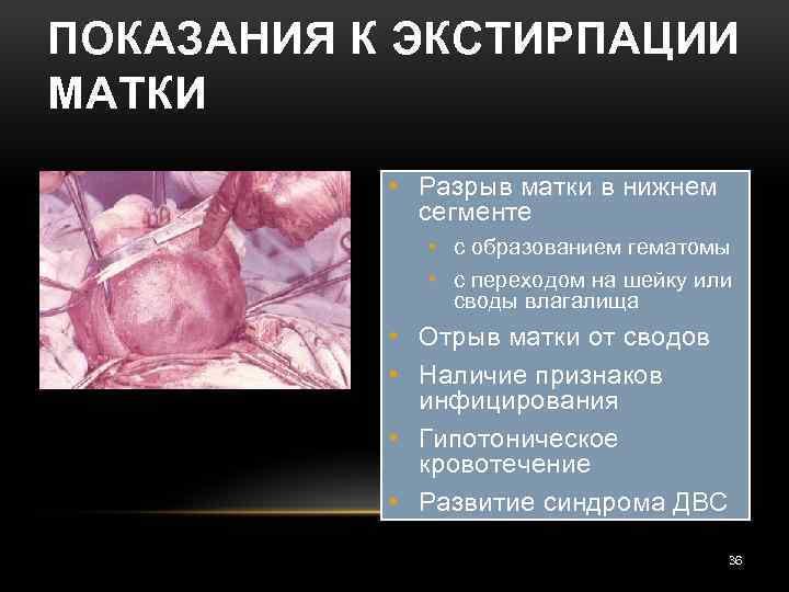 ПОКАЗАНИЯ К ЭКСТИРПАЦИИ МАТКИ • Разрыв матки в нижнем сегменте • с образованием гематомы