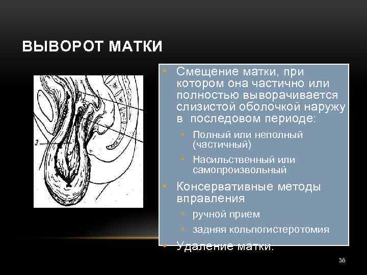 ВЫВОРОТ МАТКИ • Смещение матки, при котором она частично или полностью выворачивается слизистой оболочкой