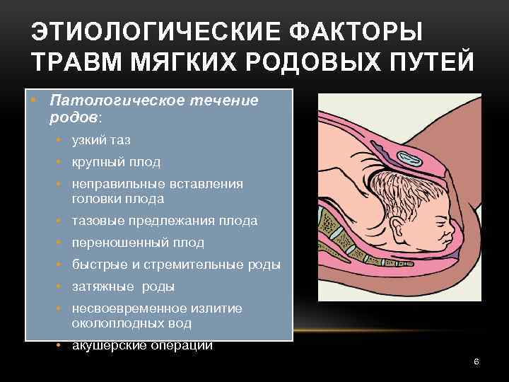 ЭТИОЛОГИЧЕСКИЕ ФАКТОРЫ ТРАВМ МЯГКИХ РОДОВЫХ ПУТЕЙ • Патологическое течение родов: • узкий таз •