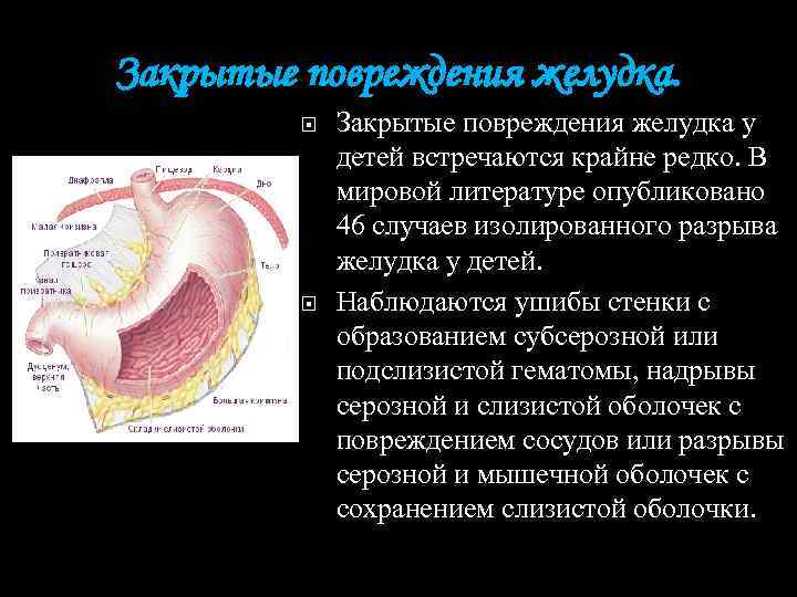 Закрытые повреждения желудка. Закрытые повреждения желудка у детей встречаются крайне редко. В мировой литературе