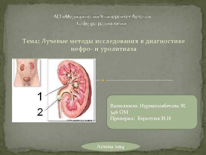 АО «Медицинский Университет Астана» Кафедра радиологии. Тема: Лучевые методы исследования в диагностике нефро- и