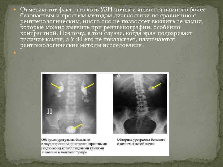  Отметим тот факт, что хоть УЗИ почек и является намного более безопасным и